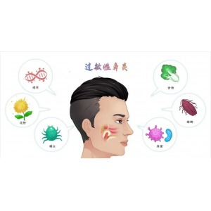 銘仁耳鼻喉專家分享：如何一招解決過敏性鼻炎的打噴嚏流鼻涕！