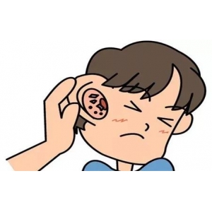 耳朵瘙癢、紅腫，外耳道濕疹不可小覷