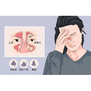 為什么感冒容易導(dǎo)致鼻竇炎，鼻竇炎該如何預(yù)防？