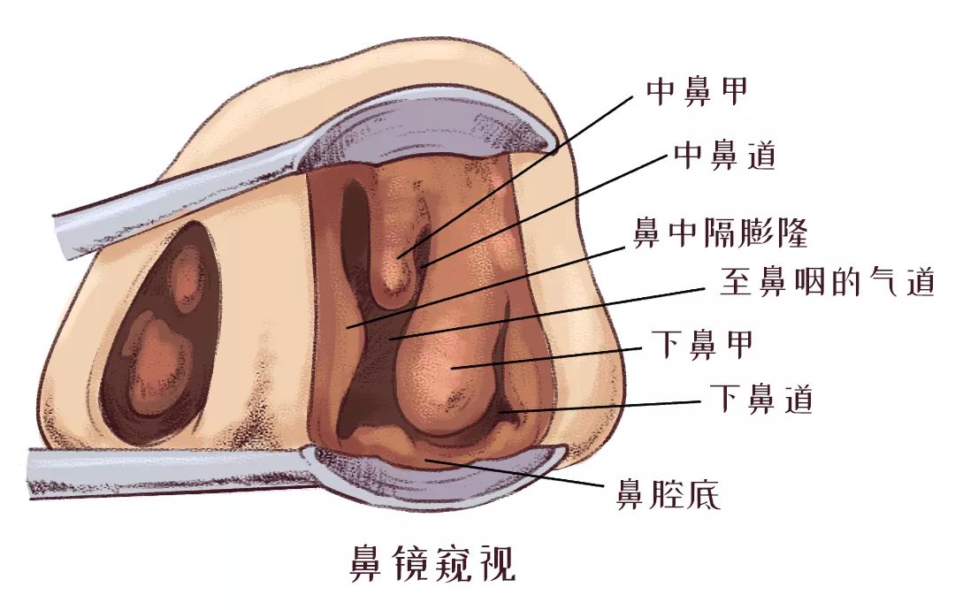 鼻甲肥大引起的呼吸困難怎么辦？(圖2)