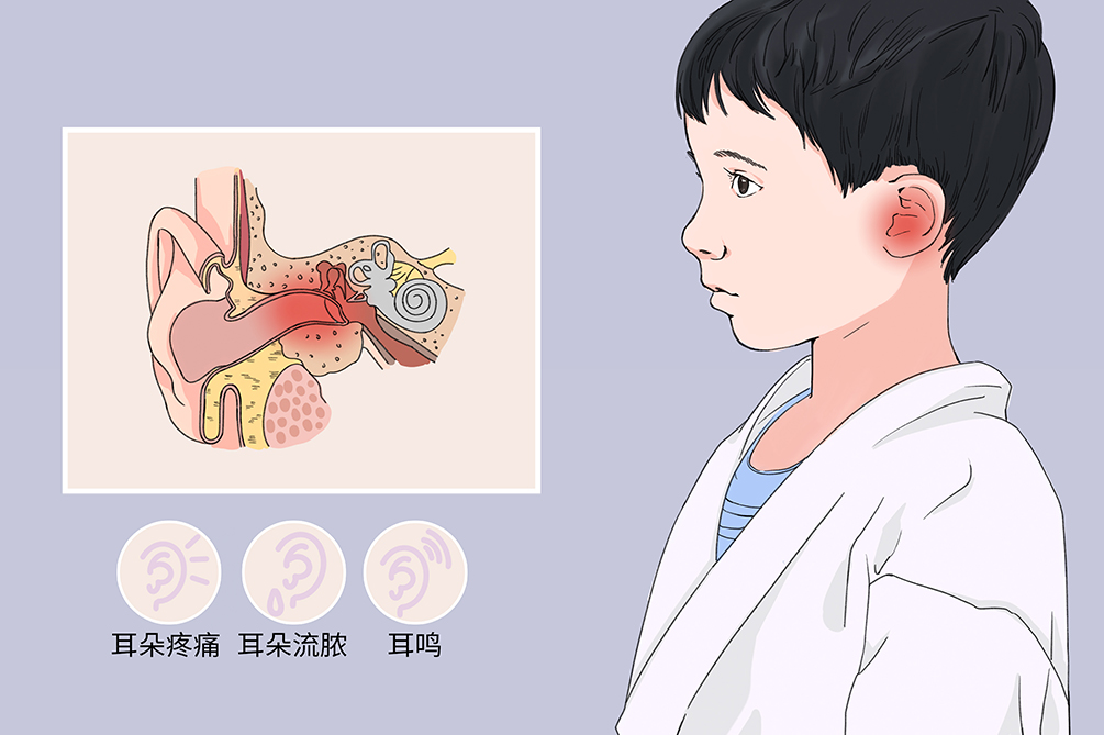 中耳炎雖小，但其危害不容小覷！(圖1)
