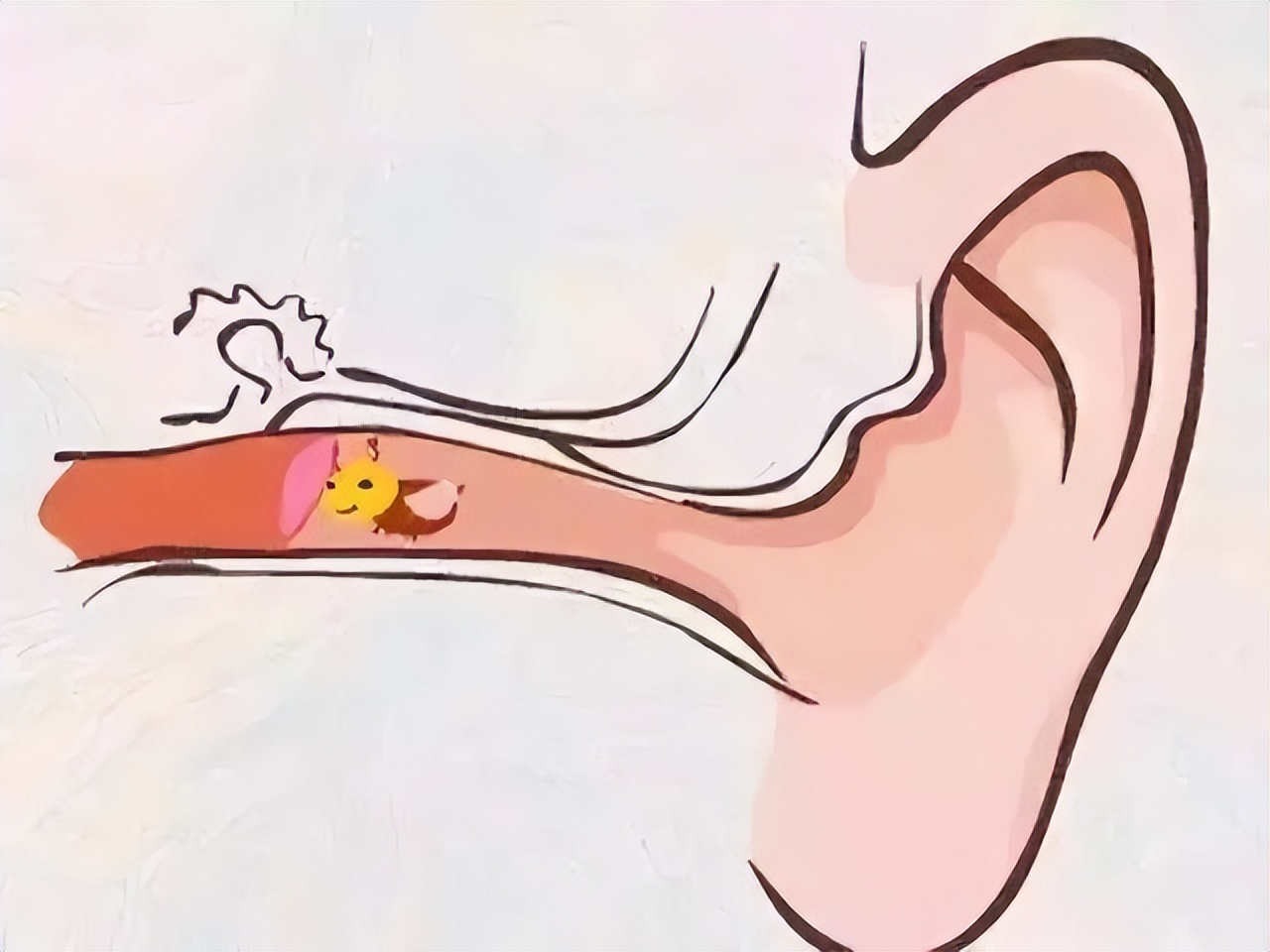 聽(tīng)力下降絕非小事，若不及時(shí)干預(yù)，嚴(yán)重會(huì)導(dǎo)致耳聾(圖1)