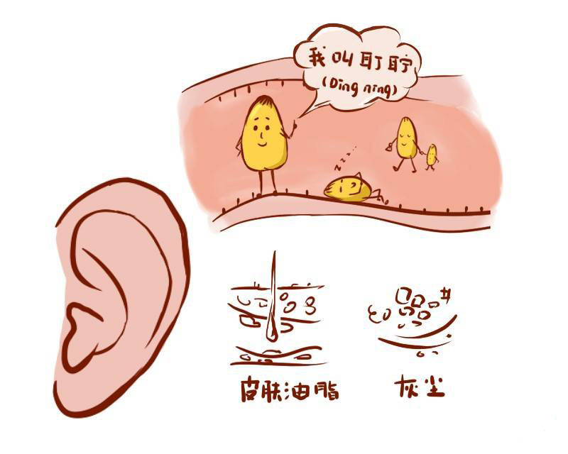 耳朵里耳屎多，到底要不要掏，正確處理方式是？(圖1)