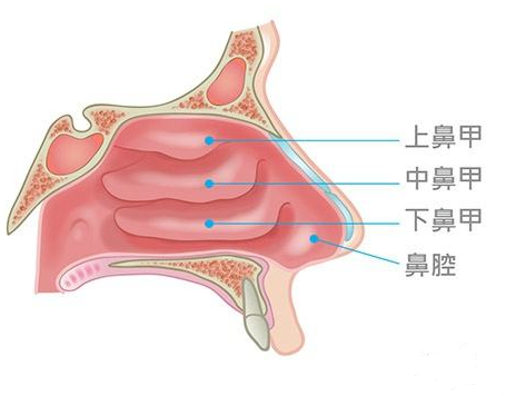 鼻甲肥大會(huì)引起面部結(jié)構(gòu)變化，還會(huì)導(dǎo)致眼袋、黑眼圈？(圖1)