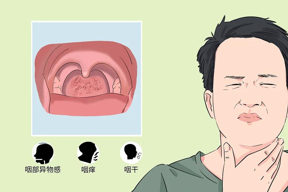 孩子咽干、喉部有異物感，警惕可能是慢性咽炎惹的禍！(圖1)