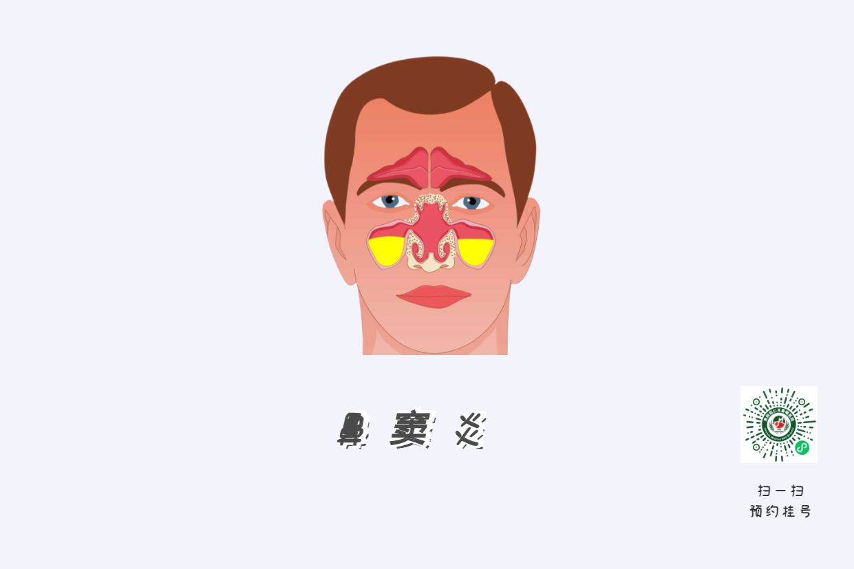 孩子成績直線下降，原來是鼻竇炎惹的禍(圖2)