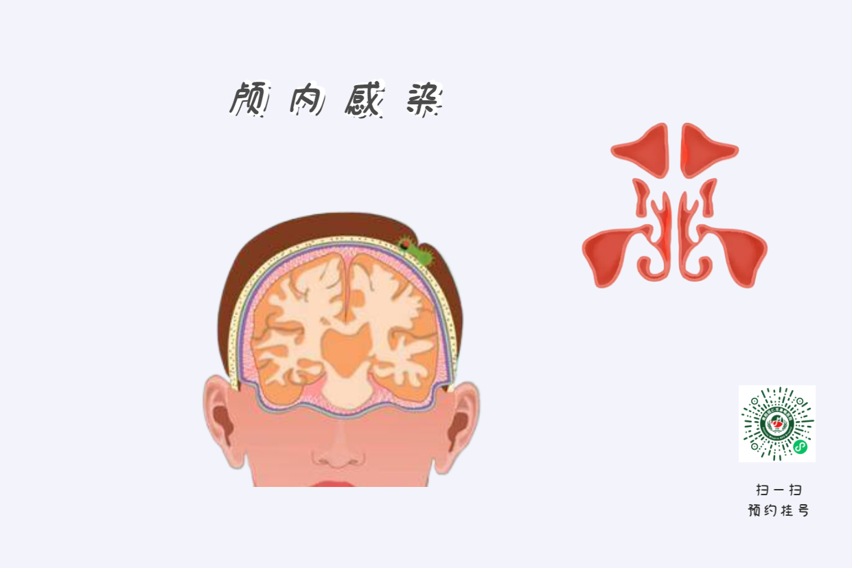為什么患上鼻竇炎，會使孩子學(xué)習成績下降？(圖3)