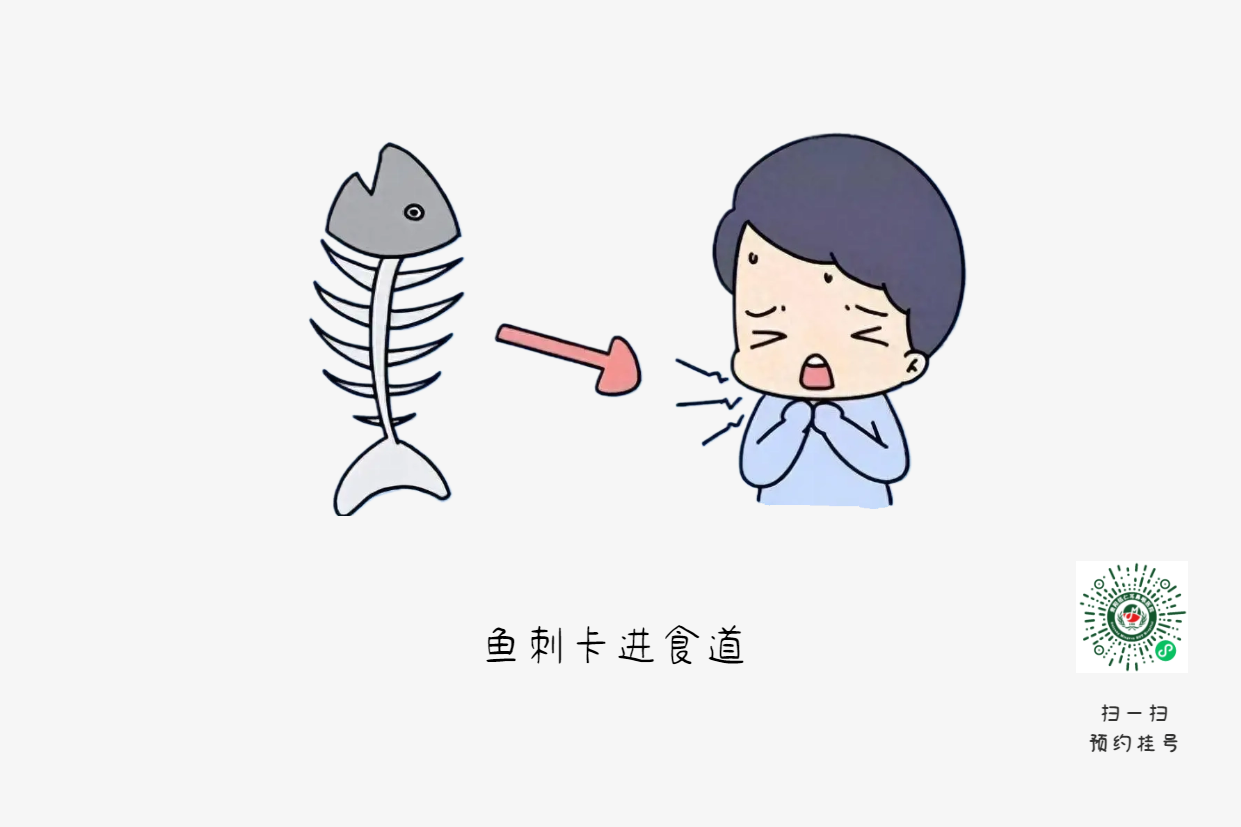 魚刺卡喉時(shí)，你的“土方法”可能讓情況更危險(xiǎn)(圖1)