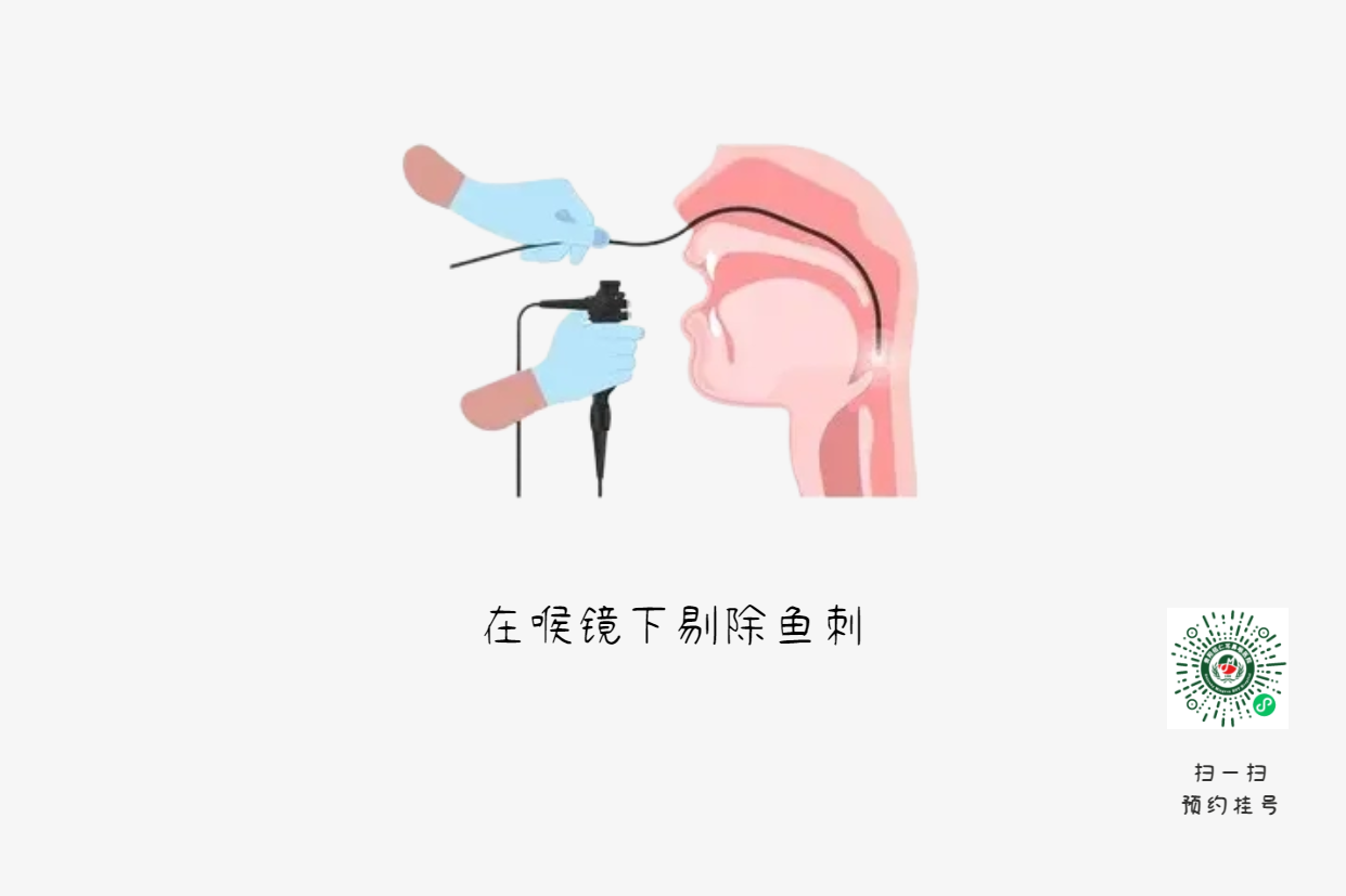 魚刺卡喉時(shí)，你的“土方法”可能讓情況更危險(xiǎn)(圖3)